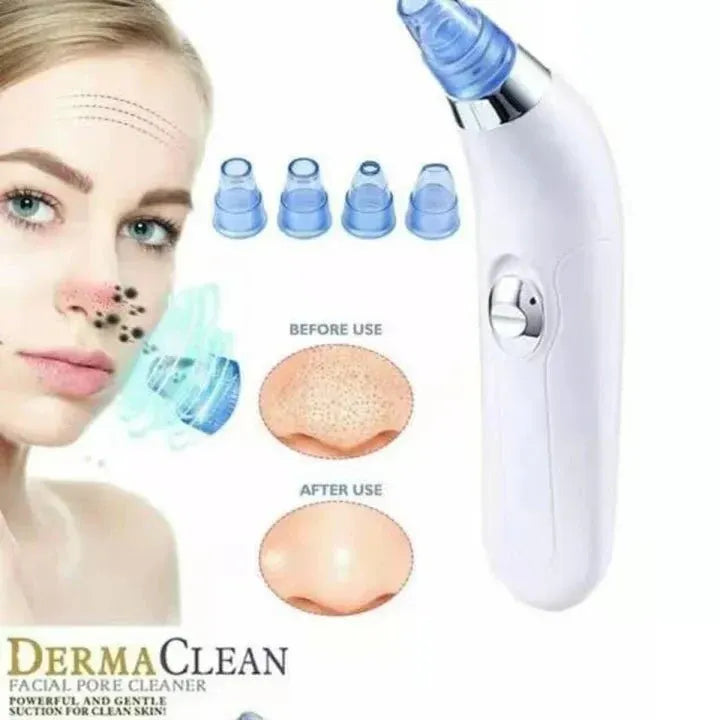 Blackhead Remover